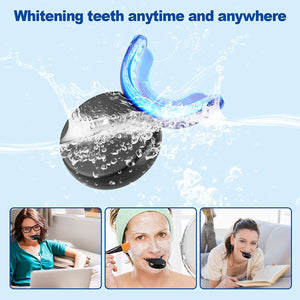 BB360 -Teeth Whitening Kit